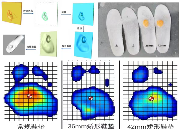瑞金骨科研究所如何利用 3D Systems 增材制造解決方案構建個性化矯形器和導板的工作流程